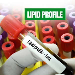 Lipid Profile