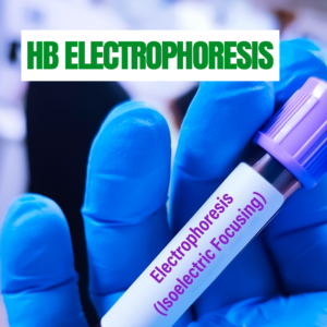 HB-ELECTROPHORESIS