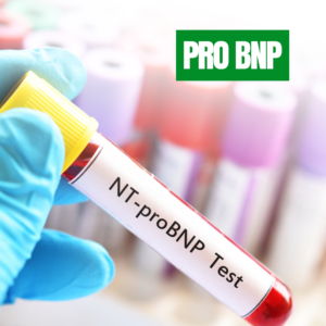 Pro BNP