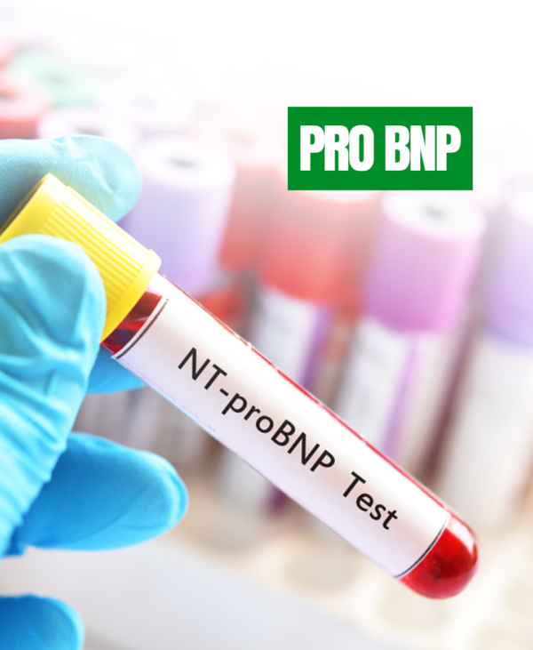 PRO BNP - EL-LAB LIMITED