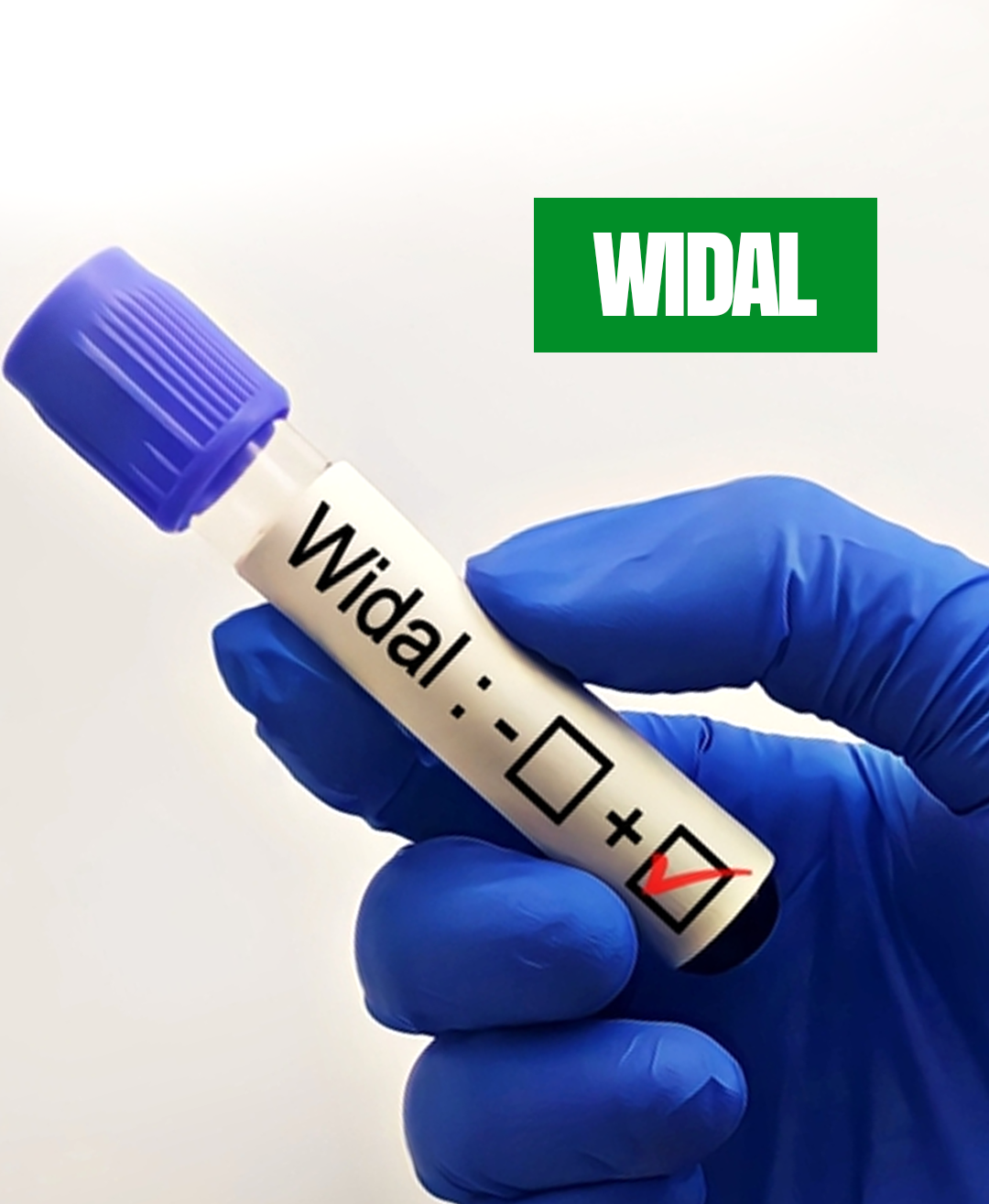 Widal